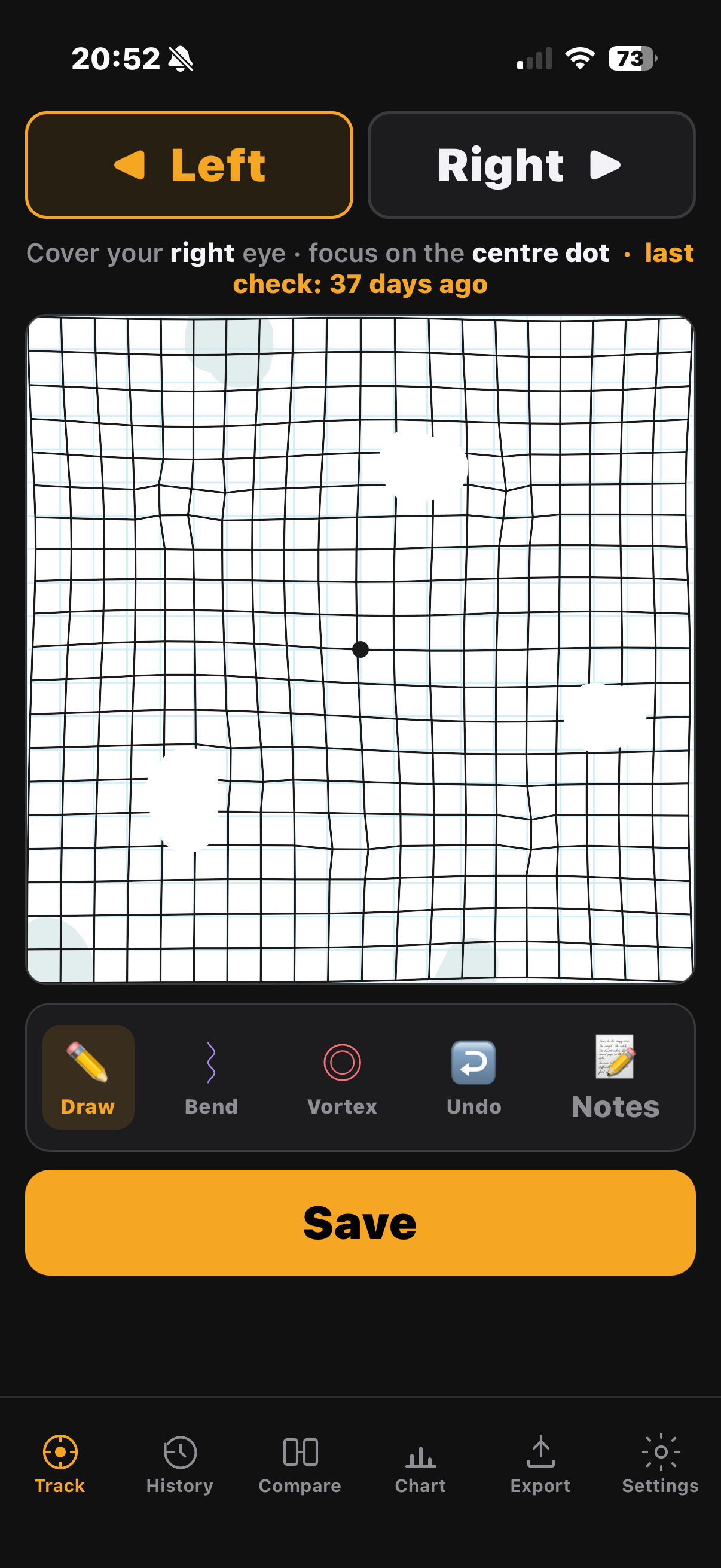 Fovcus Amsler Grid Tracker — track screen showing a marked grid